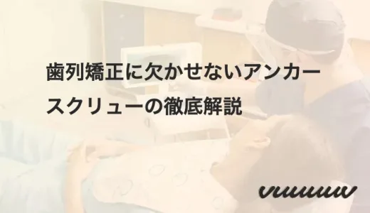 歯列矯正に欠かせないアンカースクリューの徹底解説