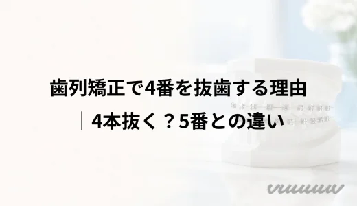 歯列矯正で4番を抜歯する理由｜4本抜く？位置と判断材料