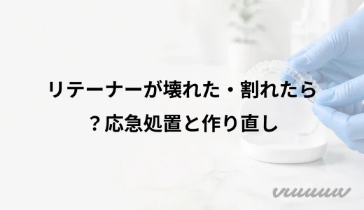 リテーナーが壊れた・割れたら？応急処置と作り直し