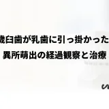 6歳臼歯が乳歯に引っ掛かった？異所萌出の経過観察と治療