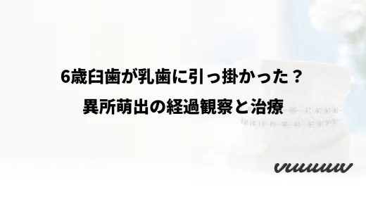 6歳臼歯が乳歯に引っ掛かった？異所萌出の経過観察と治療