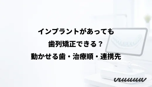インプラントがあっても歯列矯正できる？動かせる歯・治療順・連携先