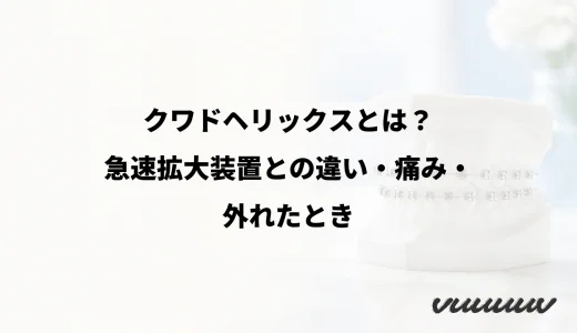 クワドヘリックスとは？急速拡大装置との違い・痛み・外れたとき