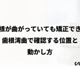 歯の根が曲がっていても矯正できる？歯根湾曲で確認する位置と動かし方