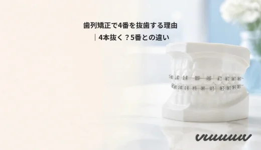 歯列矯正で4番を抜歯する理由｜4本抜く？5番との違い