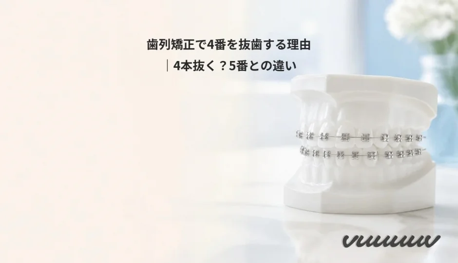 歯列矯正で4番を抜歯する理由｜4本抜く？5番との違い