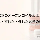 矯正のオープンコイルとは?痛い・ずれた・外れたときの対処