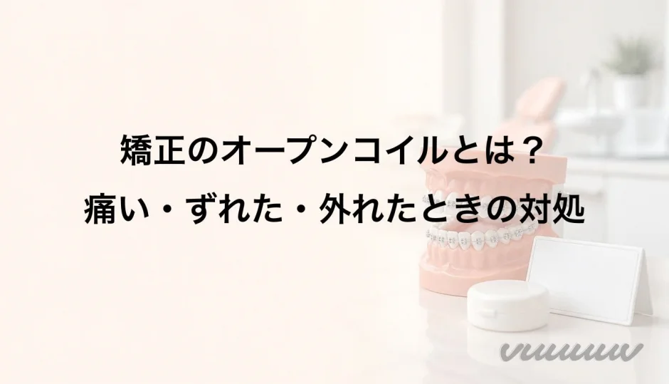 矯正のオープンコイルとは？痛い・ずれた・外れたときの対処