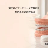 矯正のパワーチェーンが取れた・切れたときの対処法
