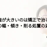 前歯が大きいのは矯正で治る?歯の幅・傾き・削る処置の違い
