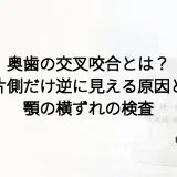 奥歯の交叉咬合とは？片側だけ逆に見える原因と顎の横ずれの検査